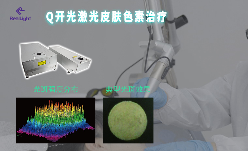 Q開光激光皮膚色素治療